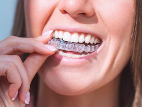 A woman placing ClearCorrect aligners over her teeth