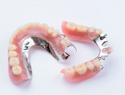 Two partial dentures shown against neutral background