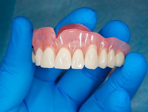 Gloved hand holding full denture for upper arch